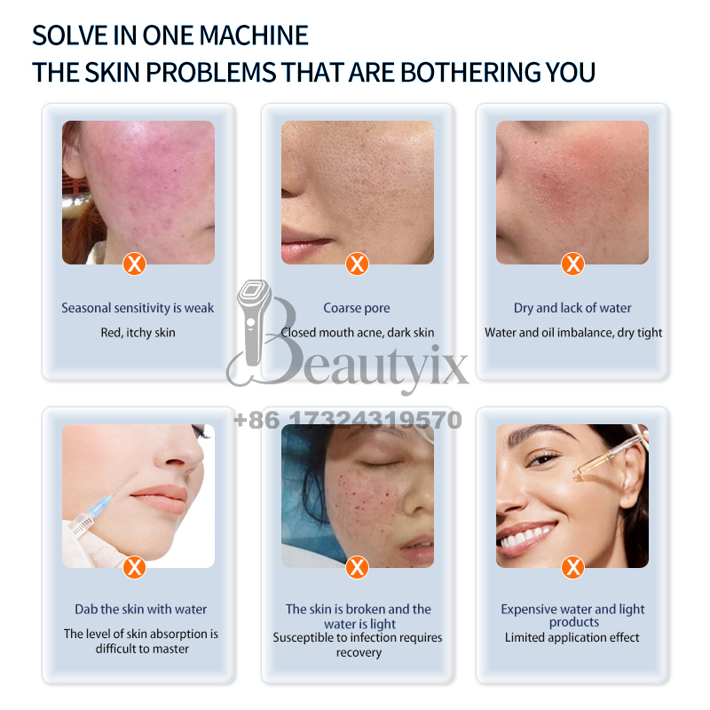 Mais Novo Equipamento de Belez - Skincare Ls avaliação e preço