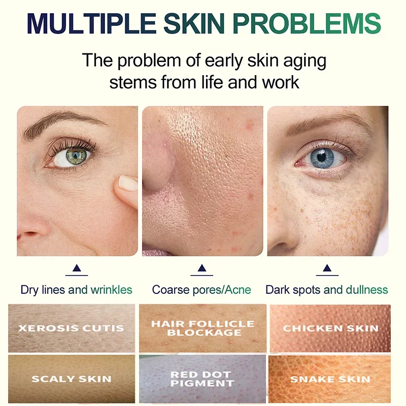 2º Sérum Facial de Ácido Salic - Glycolic Acid Exfoliant avaliação e preço