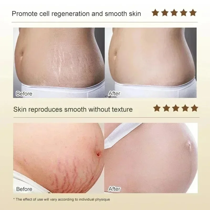 Creme de remoção permanente de - Skincare Oat avaliação e preço