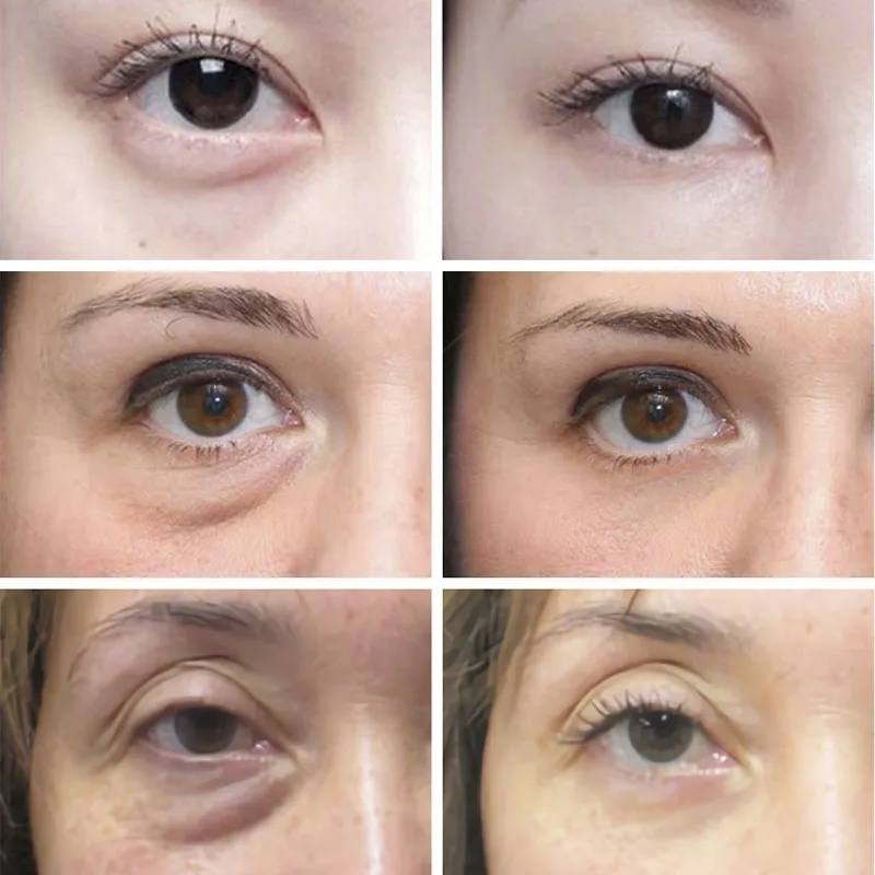 Anti rugas anti círculo escuro - Skincare D'Alba avaliação e preço