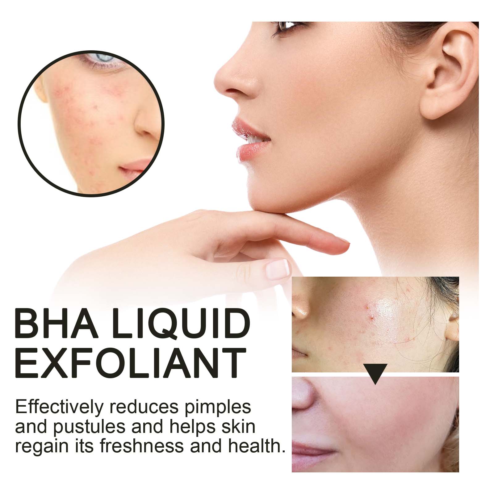 Sérum Exfoliante Líquido com 2 - Glycolic Acid Exfoliant avaliação e preço