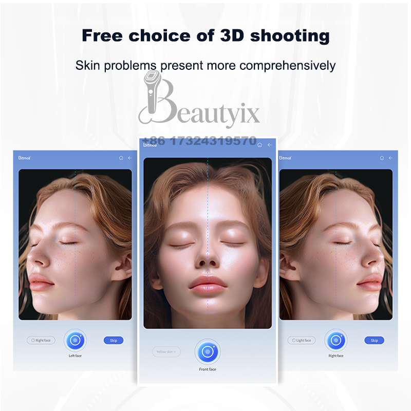 Máquina Analisadora de Pele Fa - Skincare Ls avaliação e preço